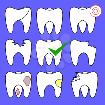 Set of Rotten Teeth and Healthy Isolated on Blue Background. Dental Treatment. SevereToothache. Filled Tooth. Symbol of Carre and Health.