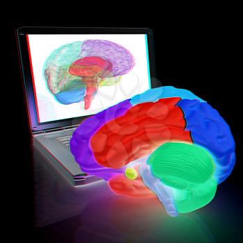 creative three-dimensional model of real human brain and scan on a digital laptop. 3d render. Anaglyph. View with red/cyan glasses to see in 3D.