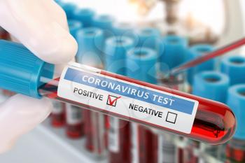 Coronavirus 2019 nCoV positive blood test. Blood sample in lhand of doctor  in laboratory. 3d illustration