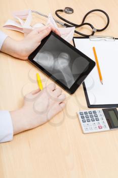 medic examines X-ray picture of human knee joint on tablet pc