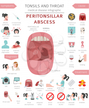 Tonsils and throat diseases. Peritonsillar abscess symptoms, treatment icon set. Medical infographic design. Vector illustration