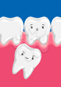 Illustration of molar squeezes out baby tooth. Children dentistry worried characters. Kawaii facial expressions.