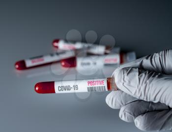 Medical glove holding a tube of blood with a positive result for test for Covid-19 or coronavirus