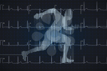 Bright blue human electro cardiogram in running shape on dark monitor, healthy life concept illustration