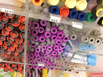 Blood test sample vials at medical laboratory close up