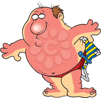 Royalty Free Clipart Image of a Sunburned Man