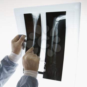 Royalty Free Photo of a Male Doctor Pointing at an X-Ray
