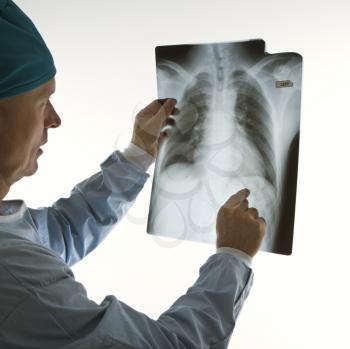 Royalty Free Photo of a Male Doctor Pointing at an X-ray