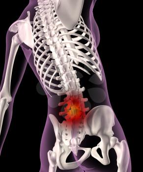 3D render of a female medical skeleton with base of spine highlighted depicting back pain