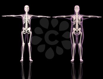 3D renders of two female skeletons one slim and one overweight