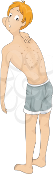 Royalty Free Clipart Image of a Man Checking His Spotted Back