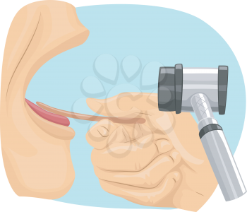 Illustration of a Man Undergoing an ENT Examination