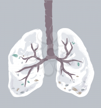 Illustration of an Upside Down Tree Shaped as Lungs with Leaves Falling Down Due to Damage
