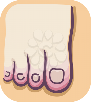 Illustration of a Foot with Red Toes