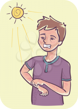 Illustration of a Man Scratching His Red Skin. Photosensitivity