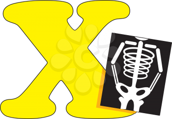 Royalty Free Clipart Image of an Xray with X
