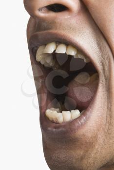 Close-up of a man's mouth wide open