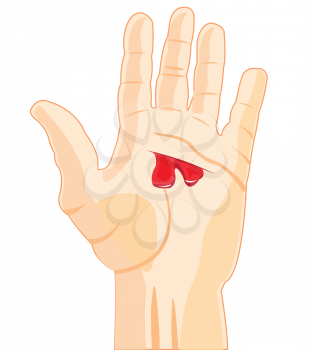 The Palm of the person with wound and blood.Vector illustration