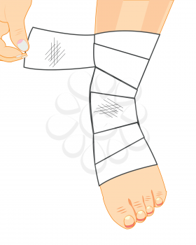 Sick leg in bandage on white background is insulated