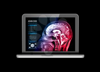 Notebook monitor with medical MRI and other real-time analyzes. Medicine of the future. Vector illustration on black background