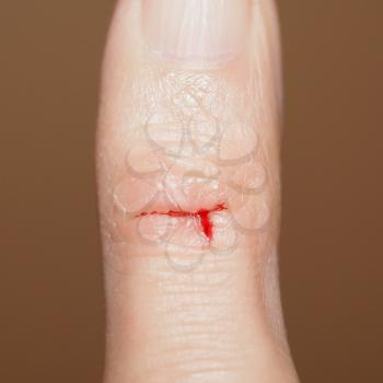 Paper cut caused by a thin sharp piece of paper slicing the skin