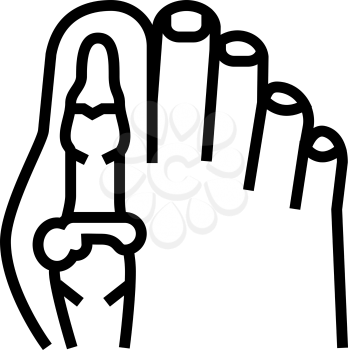 foot big toe bone gout line icon vector. foot big toe bone gout sign. isolated contour symbol black illustration