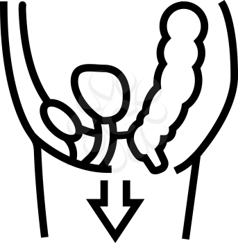 organ prolapse disease line icon vector. organ prolapse disease sign. isolated contour symbol black illustration