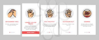 Eczema Disease Treat Onboarding Mobile App Page Screen Vector. Nummular And Neurodermatitis Eczema Treatment, Dry Skin And Pain, Contact And Atopic Dermatitis. Illustrations