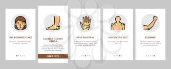 Dry Skin Treatment Onboarding Mobile App Page Screen Vector. Elbow, Face And Hand Dry Skin Treat Cream And Lotion, Bacterial Soap And Oatmeal Bath Illustrations