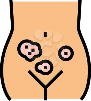 genital dermatology clinic color icon vector. genital dermatology clinic sign. isolated symbol illustration