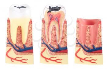 Royalty Free Photo of Tooth Anatomy