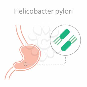 helicobacter pylori bacteria disease. human gastric stomach