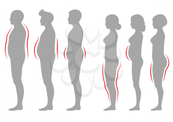 obesity woman and man body type, vector figure overweight silhouette