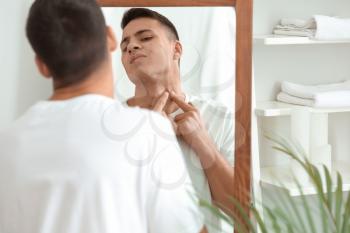 Portrait of young man with acne problem squishing pimples at home�
