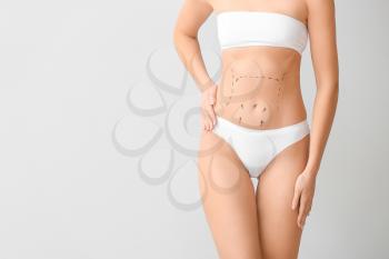 Young woman with marks on her belly against light background. Concept of plastic surgery�