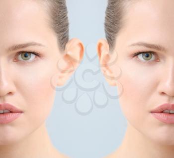 Young woman before and after plastic operation on light background, closeup�