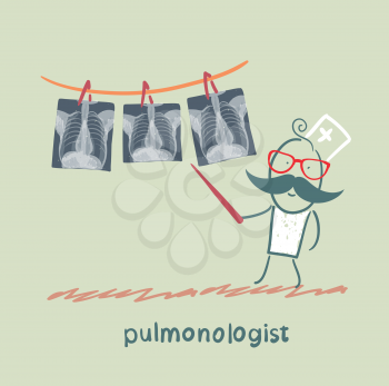 pulmonologist shows an X-ray of human lung