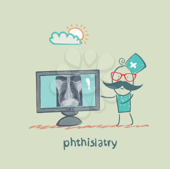 phthisiatry chest X-ray shows