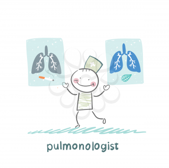 pulmonologist with placards on which painted light smoker and a healthy person