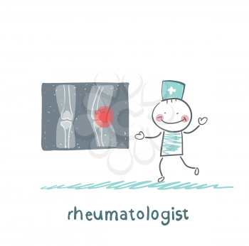 rheumatologist says about the pain in the joints of the feet and shows rengen