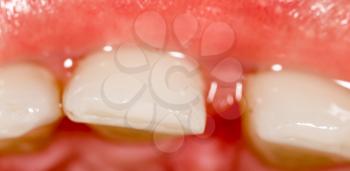 Teeth in a man's mouth as a background. macro