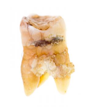 Old torn tooth on a white background .