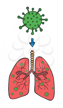 Hand drawn vector illustration of Wuhan corona virus, covid-19. The entry of the virus into the lungs through breathing.