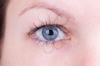 Close up of inserting a contact lens in female eye