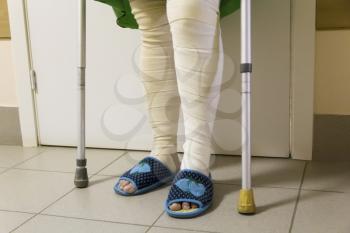Photo of bandage on the legs with crutches