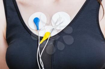 sensors of Holter monitoring of electrocardiogram are attached to girl's chest