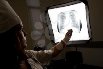 Doctor with chest X-ray isolated