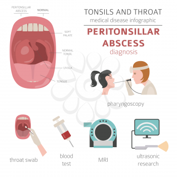 Tonsils and throat diseases. Peritonsillar abscess symptoms, treatment icon set. Medical infographic design. Vector illustration