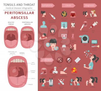 Tonsils and throat diseases. Peritonsillar abscess symptoms, treatment icon set. Medical infographic design. Vector illustration