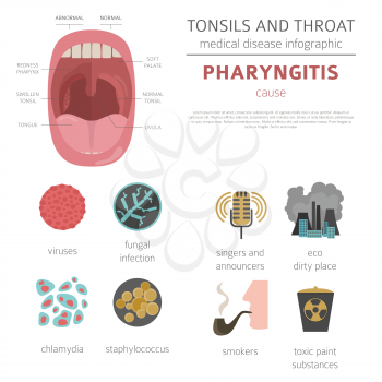 Tonsils and throat diseases. Pharyngitis symptoms, treatment icon set. Medical infographic design. Vector illustration